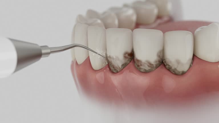 Trusted Teeth Cleaning And Checkup service in Milan, NM - Dentist Open Now